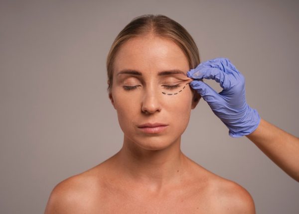 Blepharoplasty (Eyelid Surgery)
