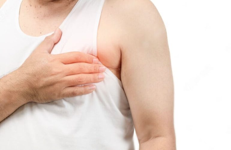Male Breast Reduction